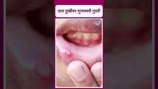 alum benefits for teeth  दात दुखीवर गुणकारी तुरटी [upl. by Elyssa556]