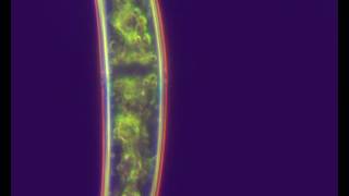 Closterium sp w ciemnym polu [upl. by Jarib]