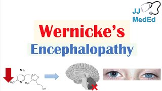 Wernicke’s Encephalopathy  Causes Symptom Triad amp Treatment [upl. by Bodrogi648]