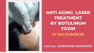 Anti Aging Laser Treatment By Botulinum Toxin at HLCCS RANCHICall now 9334334935 laser skincare [upl. by Feltie]