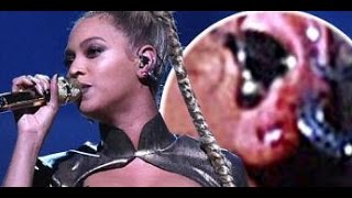 Beyonce Powers Through Tidal Concert Despite BLEEDING Ear Injury [upl. by Cardie300]