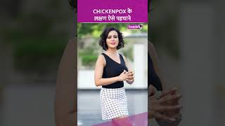 Chickenpox के ऐसे पहचाने लक्षण फैलने रोकने में मिलेगी मदद shorts chickenpox [upl. by Ayiak743]