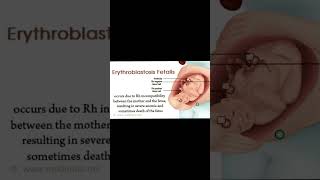 Erythroblastosis fetalis biology ncert bloodgroup shorts bodyfluids bloodpressure rhfactor [upl. by Gerita]