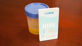 How to Perform a Urine Drug Test [upl. by Heigho439]