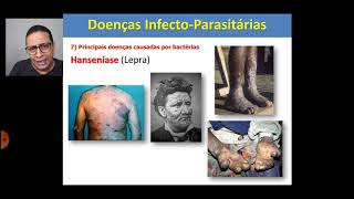 Vídeo aula sobre doença infectoparasitárias [upl. by Pride]