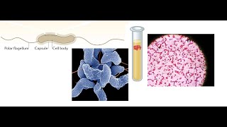 Campylobacter jejuni Part 1 Introduction Biochemical Properties and Virulence factors [upl. by Nylacaj736]