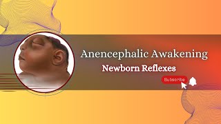 Exploring Reflexes in Babies with Anencephaly [upl. by Shabbir]