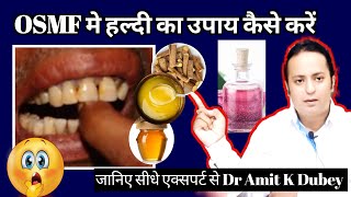 हल्दी से कैसे ठीक करें OSMF को OSMF treatment in India submucous fibrosis [upl. by Aicittel414]