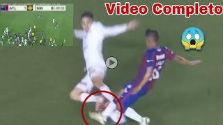 Video completo Lesión de Hobbit Bermúdez Atlante vs Dorados momento exacto [upl. by Wandy]