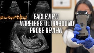 EagleView Wireless Portable Doppler Ultrasound Review  Fullbody diagnostic imaging  discount code [upl. by Chee394]