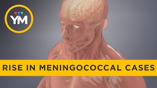 Health units report rise in meningococcal cases  Your Morning [upl. by Nosneh]