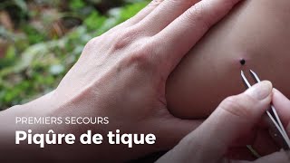 Premiers secours  Piqure de tique  Secourisme [upl. by Droc]