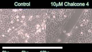 A Pivotal Role for CXCL12 Signaling in HPVMediated Transformation of Keratinocytes [upl. by Evelinn838]