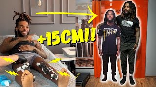 Former navy medic spends 80K to break his legs and grow 15cm taller [upl. by Hephzipah]