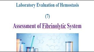 Laboratory Evaluation of Hemostasis 7 Assessment of Fibrinolytic System [upl. by Vincenta]