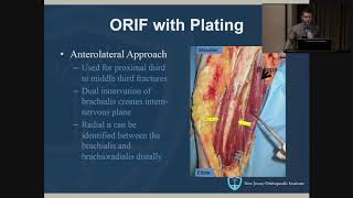 Humeral Shaft Fractures  John Callaghan MD [upl. by Eahsed]