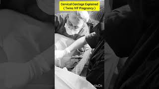 Cervical Cerclage Procedure for twin IVF pregnancy by Dr Rakshita Malik ivf pregnancy twins [upl. by Noirred]