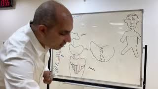 Brainstem syndromes Neuroanatomy 32 [upl. by Gannie]