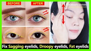 Get Big eyes view and natural Double eyelids Fix sagging eyelids droopy eyelids and fat eyelids [upl. by Ilatan696]