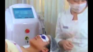 Sincoheren 808nm Diode laser hair removal system SDL C [upl. by Willner]