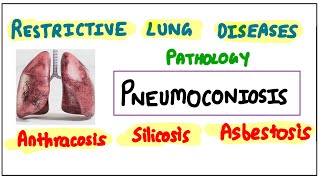 Restrictive Lung Diseases PNEUMOCONIOSIS Anthracosis  Silicosis  Asbestosis pathology robbins [upl. by Konstanze]