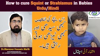 How to cure Squint or Strabismus in Babies  Urdu Hindi [upl. by Maryrose]