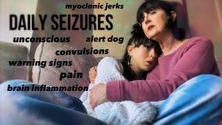 Grand Mal Seizure 20322 Living With Seizures Education Purposes [upl. by Lilah]