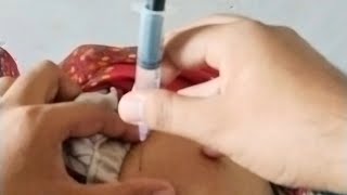 INTRAMUSCULAR INJECTIONS VIDEO PROCEDURE ll INJECTION VIDEO ll BUTTOCKS INJECTION VIDEO FOR WOMEN ll [upl. by Nylodnew]