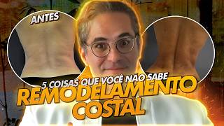 5 COISAS QUE VOCÊ NÃO SABE SOBRE REMODELAMENTO COSTAL [upl. by Ellirehs]