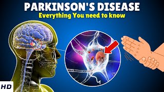 Parkinson’s Disease – Causes Signs and Symptoms Diagnosis amp Treatment [upl. by Gut115]