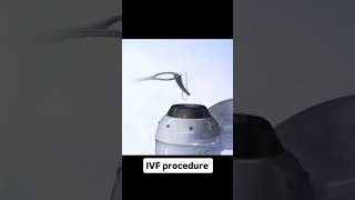 IVF Procedure in animation ivfjourney embryotransfer follicular infertility trending ytshorts [upl. by Anerres]