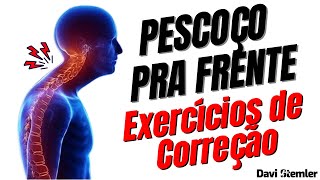 PESCOÇO PRA FRENTE Exercícios de Correção  Davi Stemler [upl. by Lashond855]