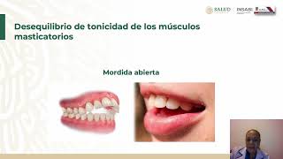 8 Maloclusiones dentales [upl. by Nodnrb]