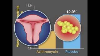 PostCesarean Infection and Antibiotic Prophylaxis  NEJM [upl. by Els]