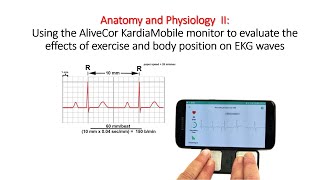 EKG Lab Using the AliveCor KardiaMobile monitor to evaluate the effects of exercise and body [upl. by Anelaf]