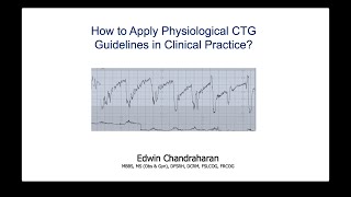 How to Apply Physiological CTG Guidelines in Clinical Practice [upl. by Oralia]