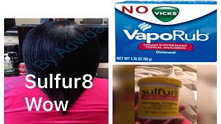 STOP Using VICKS SULFUR 8 IS AMAZING FOR SUPER FAST HAIR GROWTH [upl. by Jennilee]