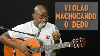 Violão Machucando o Dedo  SOLUÇÕES [upl. by Annaj264]