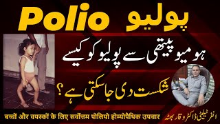 Polio پولیو पोलियो Homeopathic Treatment In Urdu  Hindi [upl. by Deer]