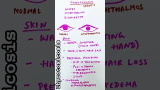 Thyrotoxicosis  Graves disease  Heat intolerance [upl. by Mussman]