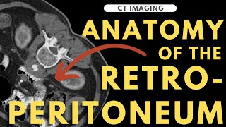 Retroperitoneal anatomy organs and spaces  Radiology anatomy part 1 prep  CT abdomen [upl. by Acsecnarf]