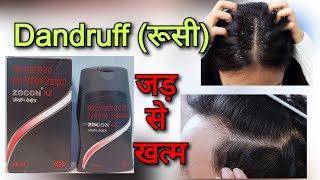 Zocon KZ shampoo uses  Ketoconazole shampoo use in hind  Dandruff treatment in hindi रूसी से राहत [upl. by Nitsir]