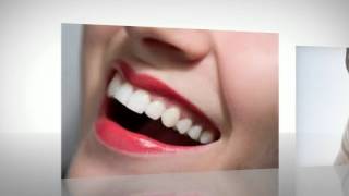 Teeth Whitening Foam [upl. by Brotherson]