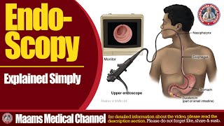 What is Endoscopy [upl. by Animsay]