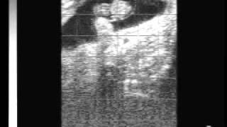 Bovine pregnancy 40 days with EasiScan ultrasoundwmv [upl. by Assirrec]