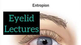 Eyelid lectures part 7 Eye opthalmology lectures  eyelectures eyelid ectropion jatoieye eye [upl. by Atsirc]