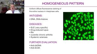 Antinuclear antibody screening  Making an informed decision [upl. by Nerehs]