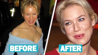 Renée Zellweger Plastic Surgery and Weight Loss Journey [upl. by Aklim439]