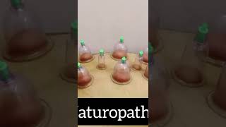 Benefits of cupping therapy cupping benefits gymmotivation fitnessmotivation shorts [upl. by Block]