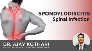 जाणिये Spinal Infection Spondylodiscitis क्या होता है  Signs Symptoms Diagnosis amp Treatment [upl. by Attenev]